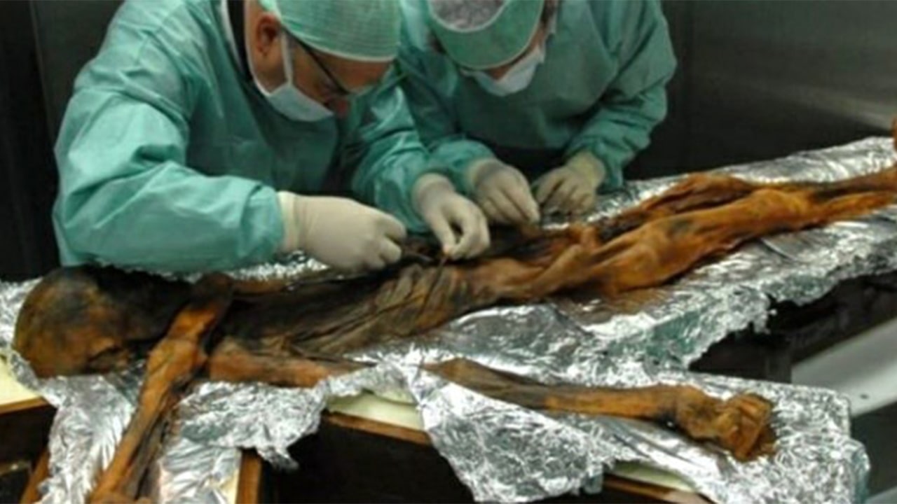 preserved human being